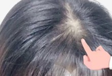 没有了意识的人的命运（揭示无意识状态下的人类生活真相，探索寻找希望的奇幻之旅）